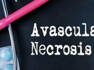 Avascular Necrosis Treatment Costs in India